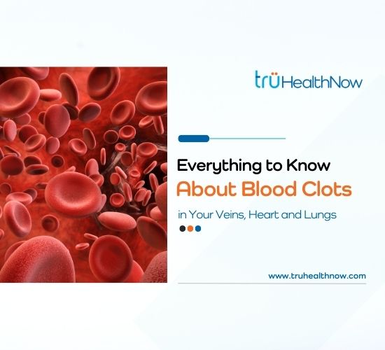 Everything to Know About Blood Clots in Your Veins, Heart and Lungs